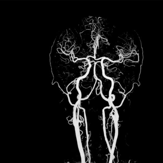 Orden Médica AngioTAC Cerebro – Evaluación Precisa del Flujo Sanguíneo Cerebral