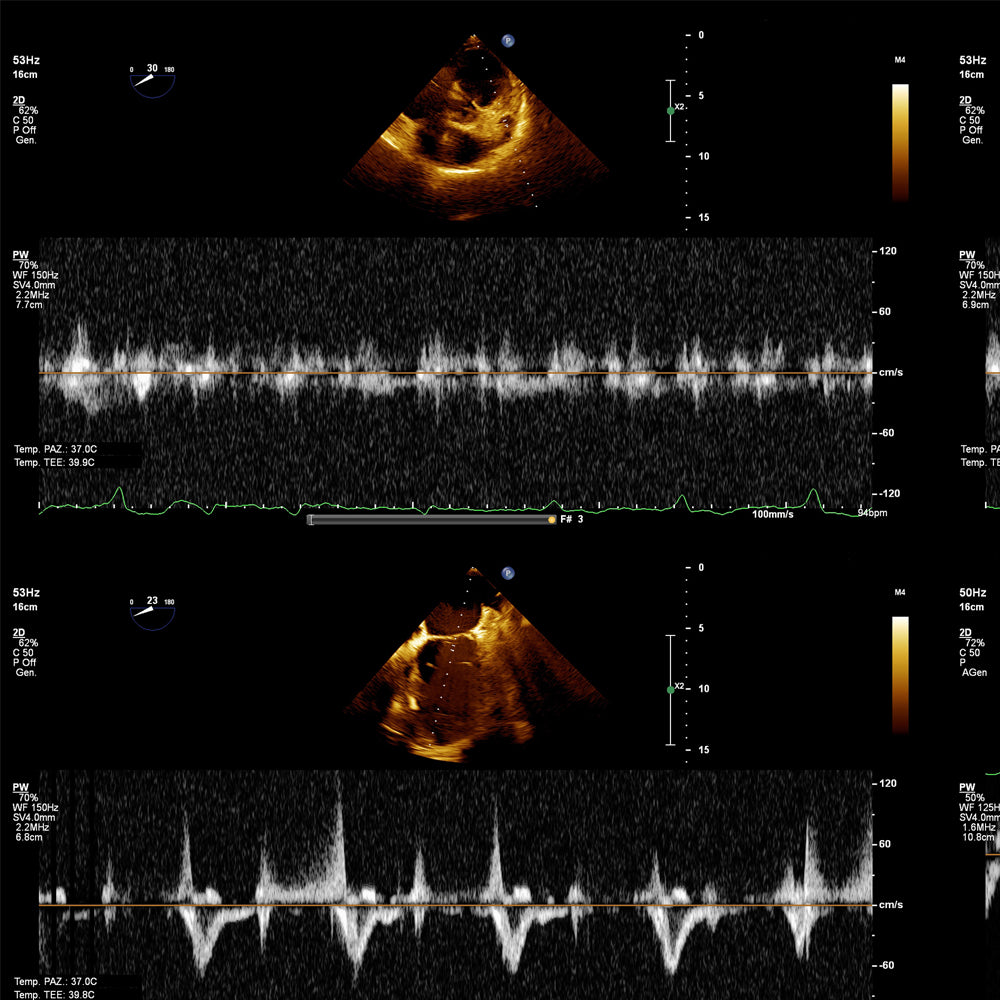 Orden Médica para Ecocardiograma Doppler | Análisis del Corazón y Flujo Sanguíneo