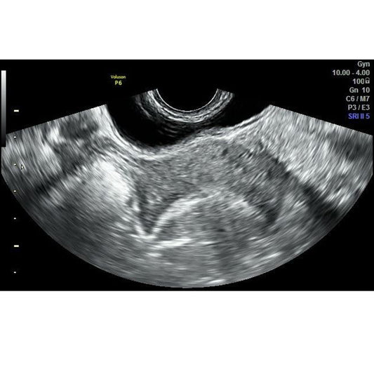 Orden Médica Ecografía Transvaginal – Evaluación Ginecológica Detallada