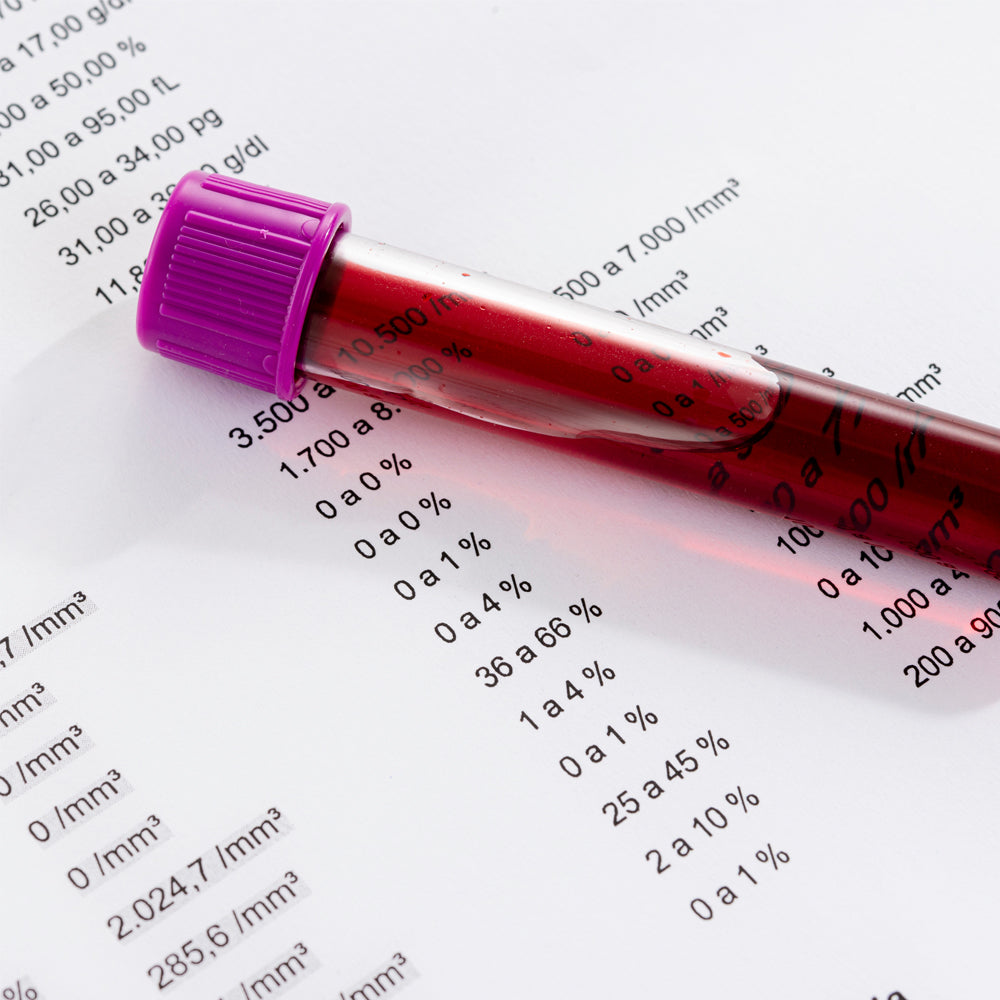 Orden Médica para Flebotomía – Procedimiento Terapéutico para Control de Hierro en Sangre