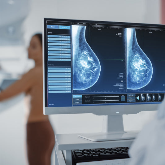 Orden Médica para Mamografía | Prevención y Detección Oportuna