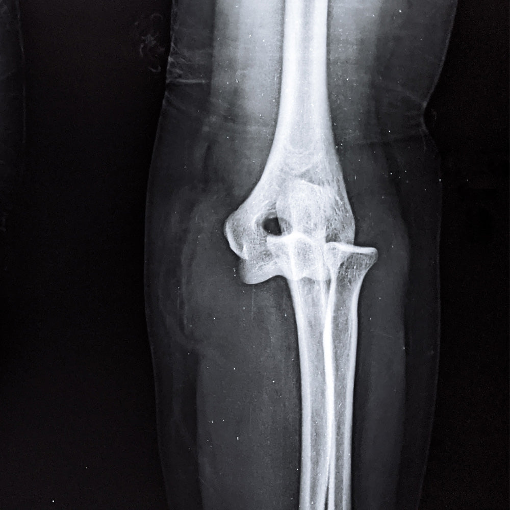 Orden Médica Radiografía de Codo – Diagnóstico Preciso y Rápido para tu Salud Articular
