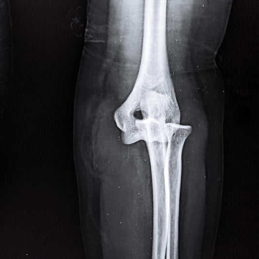 Orden Médica Radiografía de Codo – Diagnóstico Preciso y Rápido para tu Salud Articular