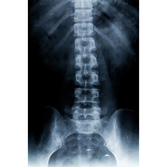 Orden Médica Radiografía de Columna – Diagnóstico Rápido para Dolor de Espalda y Evaluación Vertebral