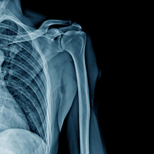 Orden Médica para Radiografía de Hombro – Diagnóstico Claro y Preciso
