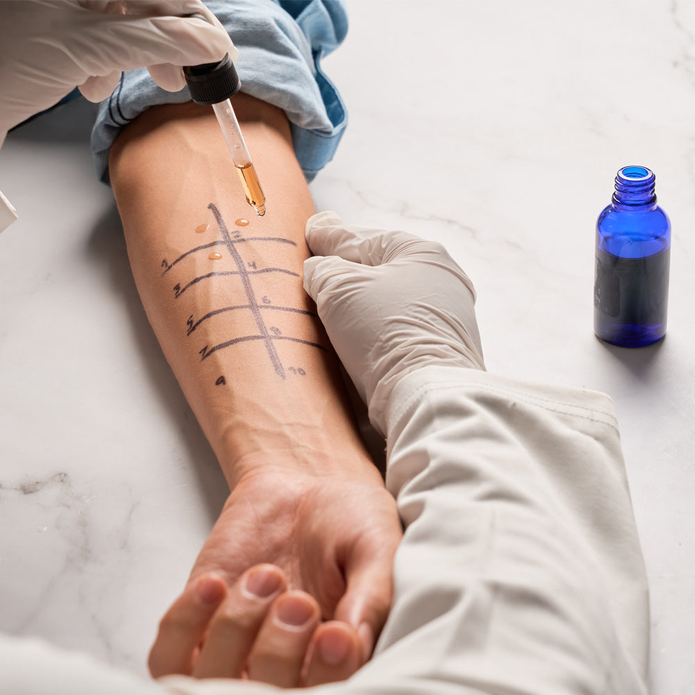 Orden Médica Test Cutáneo Prick Test – Diagnóstico de Alergias Ambientales y Alimentarias