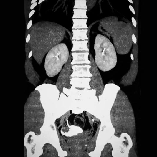 Orden Médica UROTAC con Contraste – Diagnóstico Avanzado del Tracto Urinario