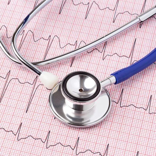 Electrocardiograma (ECG)