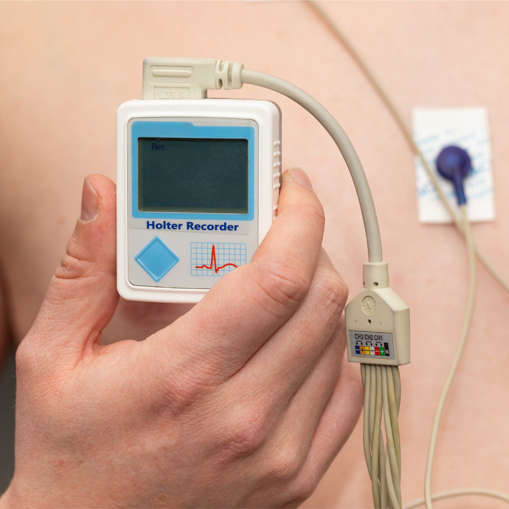 Orden Médica Holter de Ritmo y Presión Arterial – Monitorización Cardiaca en Tiempo Real