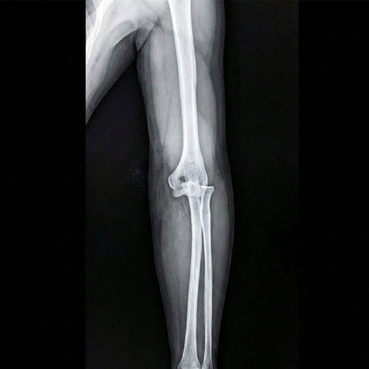 Orden Médica Radiografía de brazos y antebrazos – Evaluación de Fracturas y Lesiones Óseas