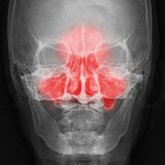 Orden Médica Radiografía de Cavidades Paranasales – Diagnóstico Rápido para Sinusitis y Más