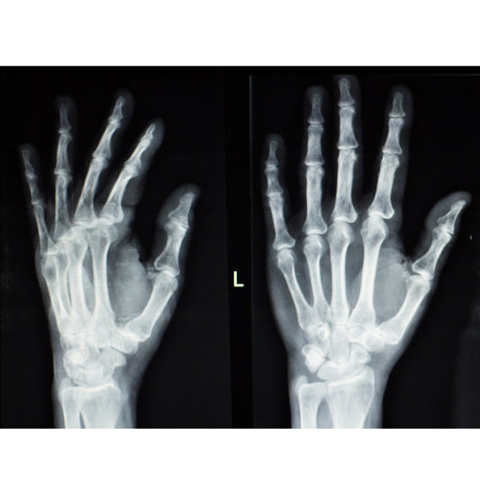 Orden Médica Radiografía de Mano y Muñeca – Diagnóstico Rápido para Lesiones Óseas o Dolor Articular