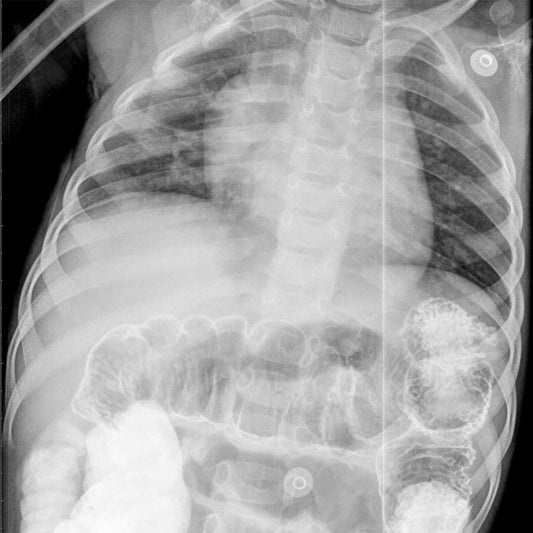 Orden Médica para Radiografía Abdominal | Diagnóstico Preciso y Rápido