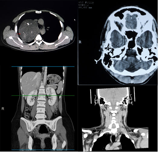 Orden Médica Tomografía (TAC) Completa – Evaluación Integral de Todo el Cuerpo en un Solo Estudio