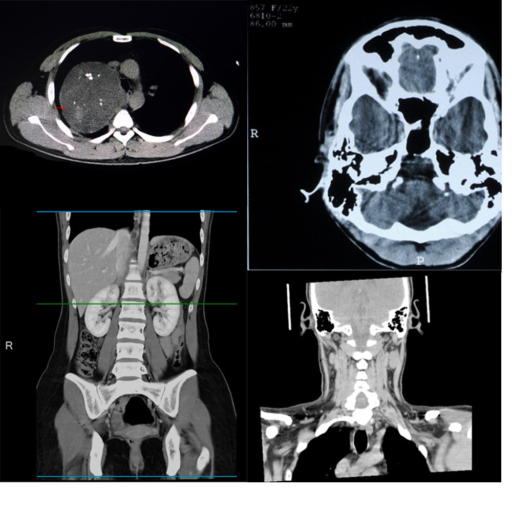 Orden Médica Tomografía (TAC) Completa – Evaluación Integral de Todo el Cuerpo en un Solo Estudio