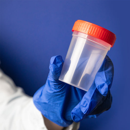 Orden Médica Test Inmunoquímico Fecal (FIT) – Detección Temprana de Sangre Oculta en Heces